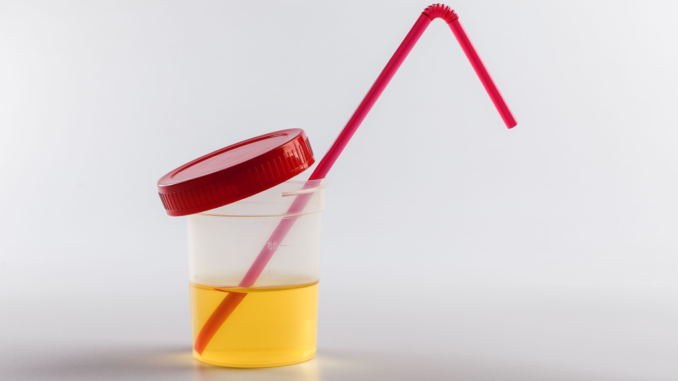 Can Urine Therapy Reverse The Effects Of The COVID Vaccines?
