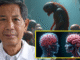 Parasites Found In Vaxed Brains